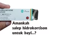 salep hidrokortison untuk bayi